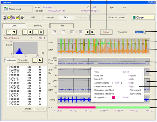 SCM-510W-Fukuda Denshi-ECG Holter softwave3.jpg